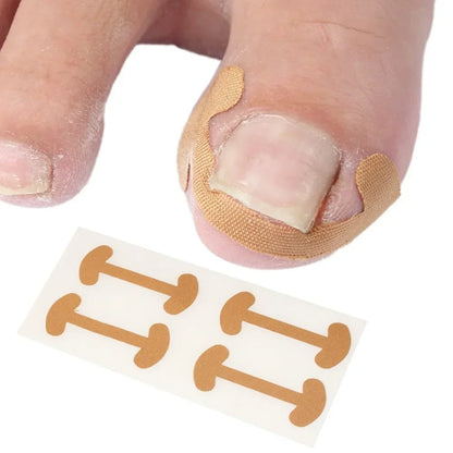 Gentle Toe Pain Relief Stickers