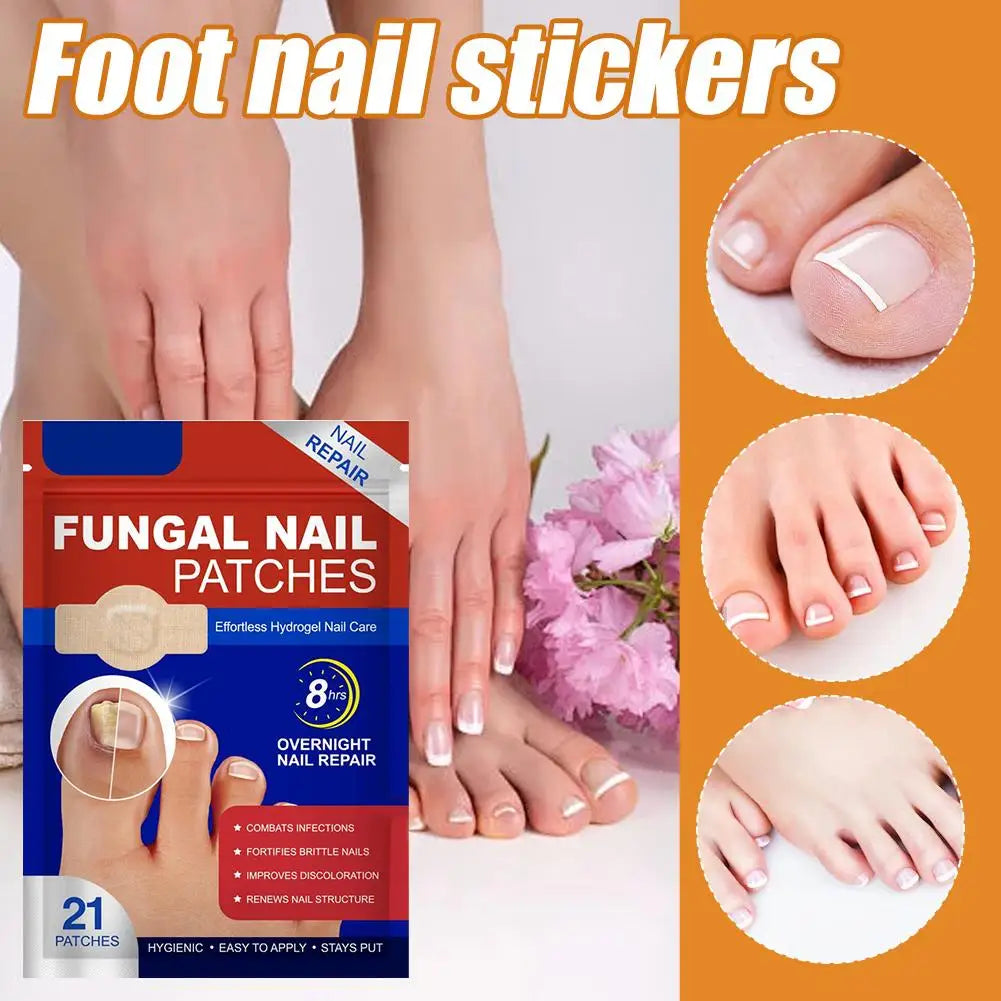Fungal Nail Patches