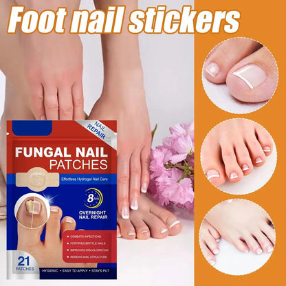 Fungal Nail Patches