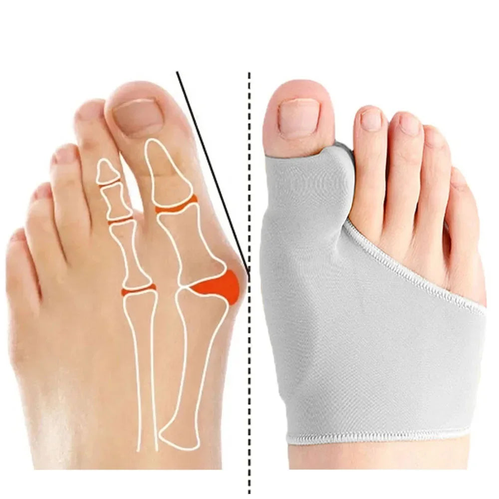 Comfort Fit Bunion Sleeve