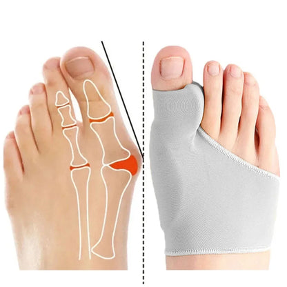 Comfort Fit Bunion Sleeve