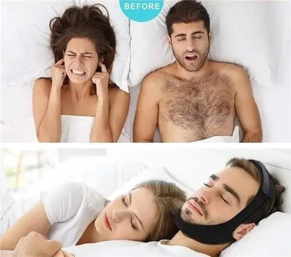 Snore-Free Sleep Strap